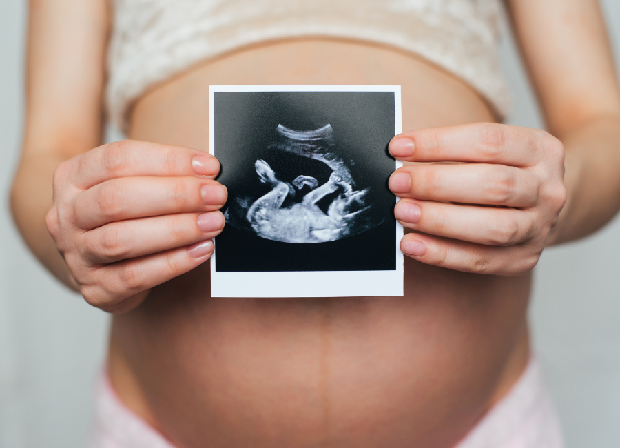 i primi movimenti fetali mamma incinta tiene in mano ecografia